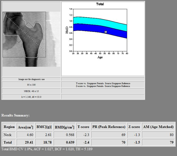 Postoperative BMD