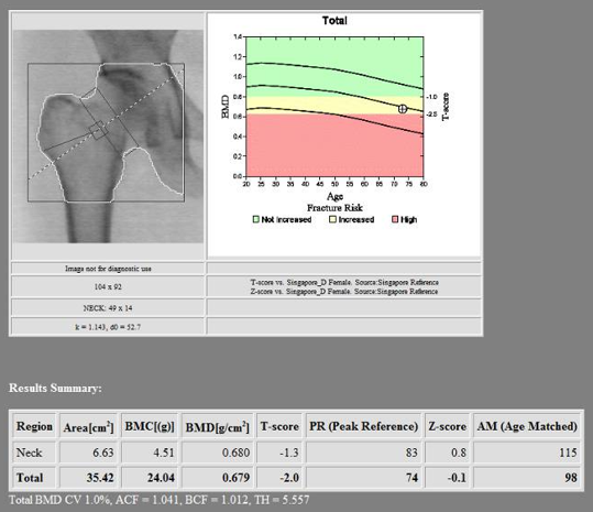 BMD after 1-year romosozumab