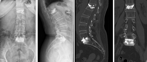 Postoperative findings