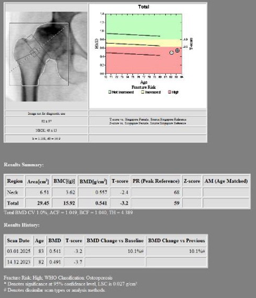 Right Hip BMD After Romosozumab Initiation