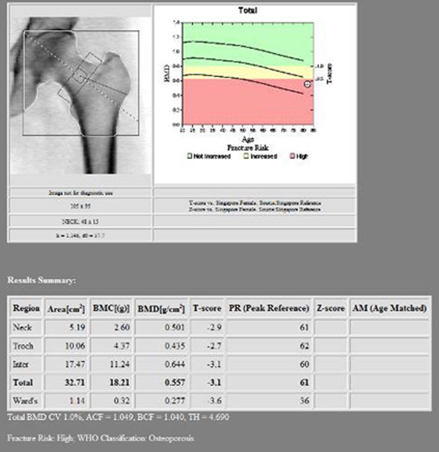 BMD on August 2024
